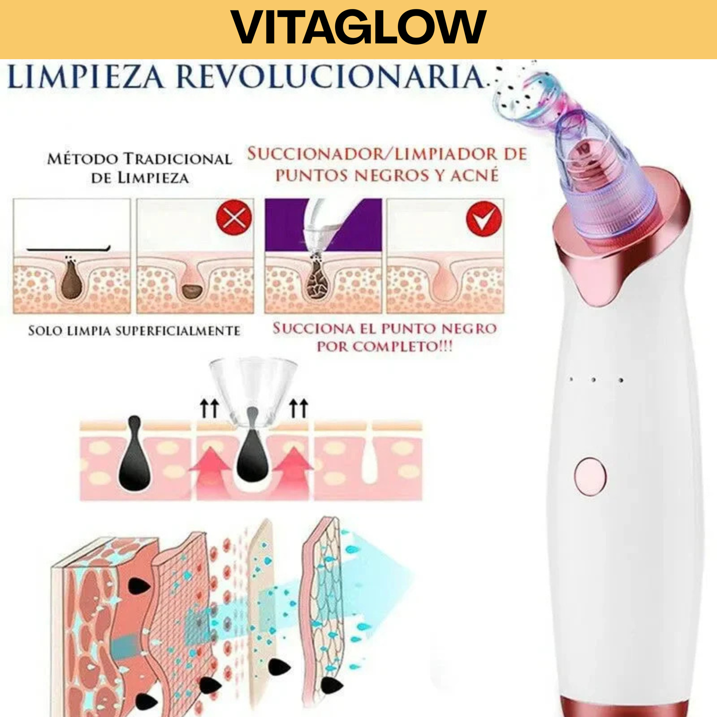 Limpiador de Puntos Negros VitaGlow – Piel Limpia y Suave al Instante