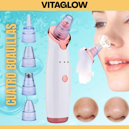 Limpiador de Puntos Negros VitaGlow – Piel Limpia y Suave al Instante