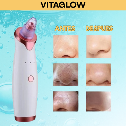 Limpiador de Puntos Negros VitaGlow – Piel Limpia y Suave al Instante